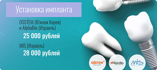 Установка импланта